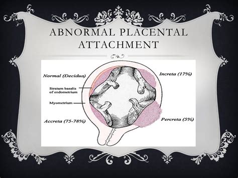 Placenta Previaplacental Abruption
