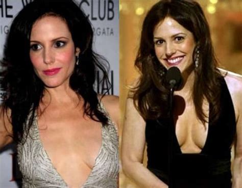 Mary Louise Parker Plastic Surgery Before And After Photos