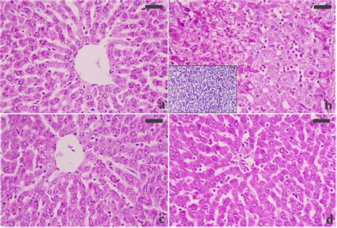 Normal Liver Histology