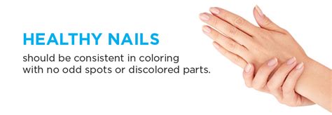Having vertical (longitudinal) ridges on the fingernails refers to the presence of tiny raised lines or ridges that run up and down the length of the nail. What Do the Vertical Lines on My Nails Mean? - FutureDerm