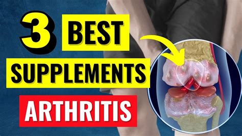 The 3 Best Arthritis Supplements That ACTUALLY Work YouTube