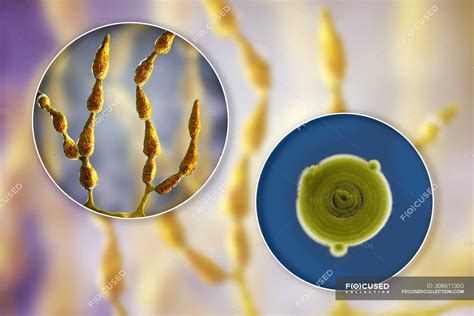 Digital Illustration Of Fungal Morphology Of Filamentous Allergenic