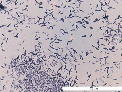 A microbial biorealm page on the genus clostridium tetani. b. Spores and bacteria of Clostridium tetani with a ...