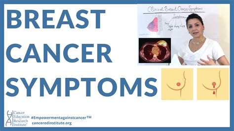 What Are Breast Cancer Symptoms What Do You Need To Look For During