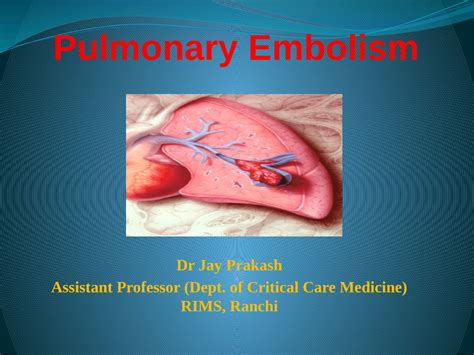 Pdf Pulmonary Embolism