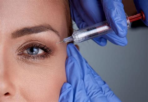 Aplicação de botox o que é duração mitos e verdades e como funciona