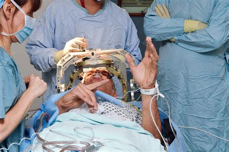 Deep Brain Stimulation Surgery Stock Image C0360668 Science