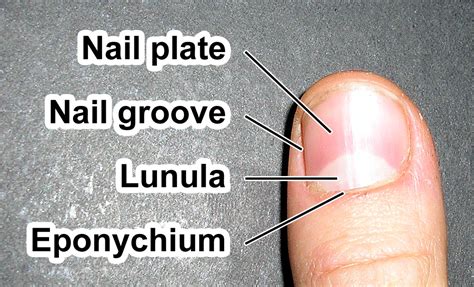 Havin' trouble with the livin'? LawsDystopiaBlog: Come Sta La Luna: fingernails and depression