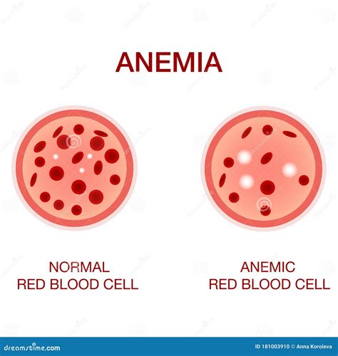Anemia And Red Spots On Skin
