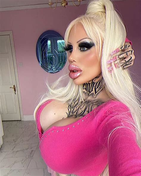 Plastic Bimbo Alicia Amira Gives Update On Surgery Daily Star