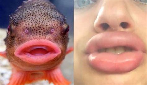 Big Fish Lips Cartoon Lipstutorial Org