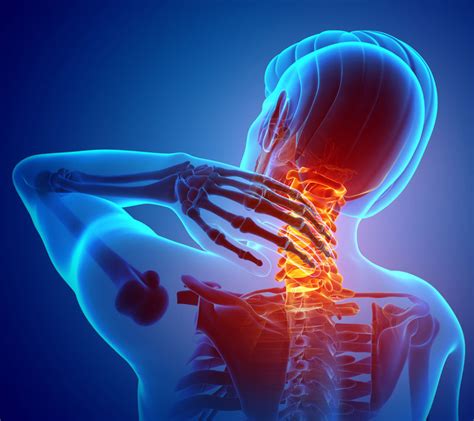 Neck And Back Pain Bay Area Orthopaedic Specialists
