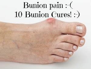 How to prevent bunions it's never too late to prevent bunions from forming or getting worse. How to Get Rid of Bunions - 10 Bunion Cures - HopingFor Blog