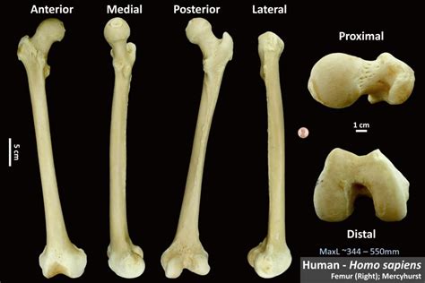 Human Femur Osteoid Bone Identification