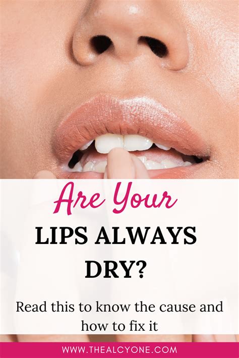 10 Reasons Why Your Lips Are Dry And How To Fix It Healing Dry Lips