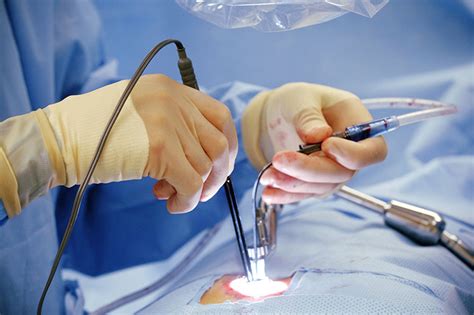 All You Need To Know About Minimal Invasive Cardiac Surgery Minimal Invasive Surgery