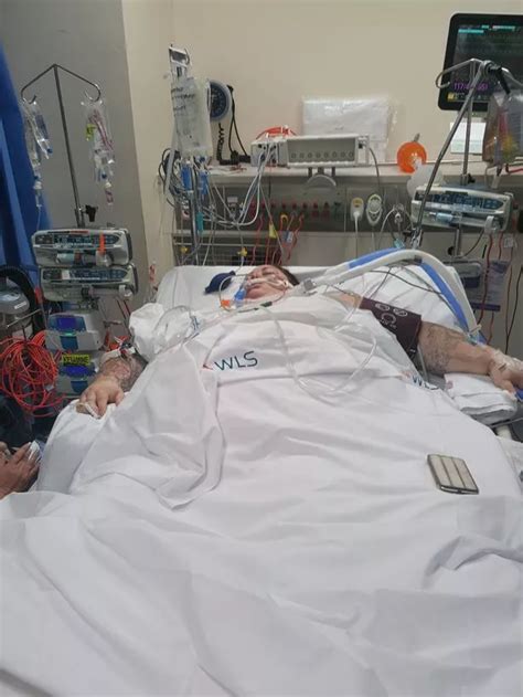 26 Stone Woman Wakes From Coma To Marry Naked In Front Of 700 People