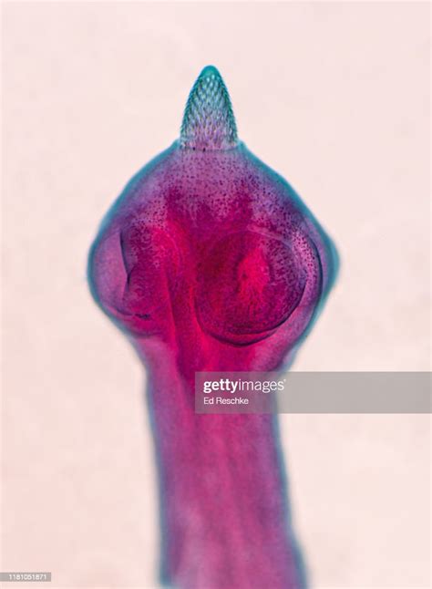 Dog Tapeworm Scolex With Suckers And Rostellum With Hooks 25x High Res