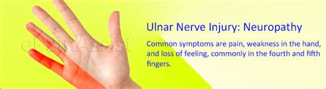 Ulnar Nerve Injury Symptoms