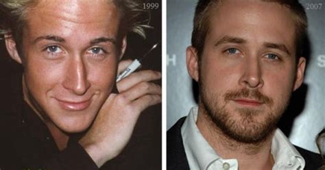 Ryan Gosling Nose Job Before And After Photo Smashing Surgery Nose Job Celebrity Surgery