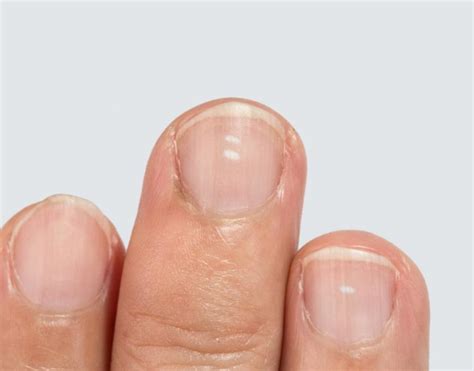 Are Your Nails Trying To Tell You Something
