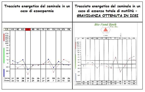 Lo spermiogramma è l'esame dello sperma che misura la quantità e qualità del liquido emesso durante l'eiaculazione, valutando sia gli spermatozoi che il liquido seminale. Spermiogramma (Esame del liquido seminale) - Centro ...