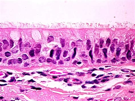 Sos Biologia Celular Y Tisular Tejidos Epitelios Traquea Tissue