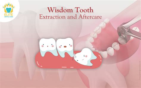 Wisdom Tooth Extraction And Aftercare Everything You Need To Know