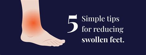 How To Reduce Swelling In Feet Rela Hospital