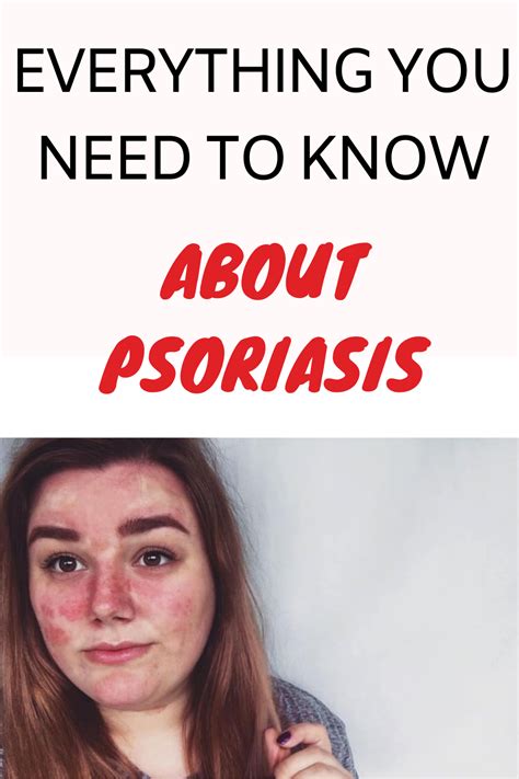 Psoriasis Is A Skin Disease That Makes People Suffer We Explain What Can Help Patients With