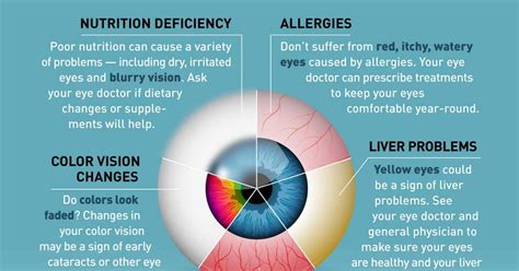 Hp Wa 0812 1456 Learn About Eye Health Eye Conditions And Diseases Usher