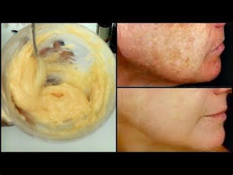 It won't be the usual thick mask that you're used to, but you don't need it to be. YouTube | Ingrown hair, Ingrown hair serum, Homemade lotion