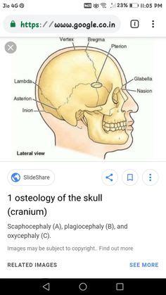 Maybe you would like to learn more about one of these? Junctions on skull: bregma, lambda, asterion, pterion ...