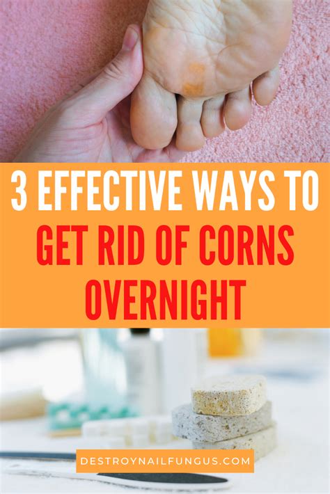 3 Ways On How To Remove Corns On Your Feet Overnight