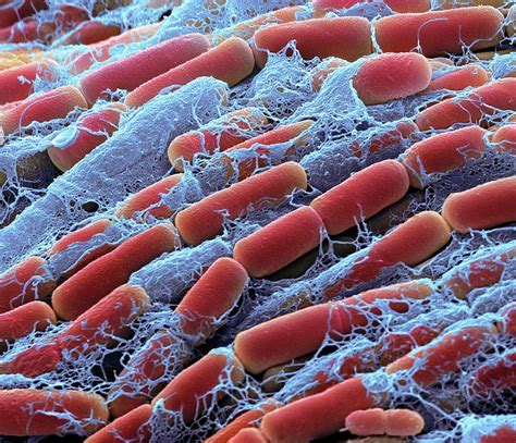 Bacillus Megaterium Bacteria Photograph By Steve Gschmeissner