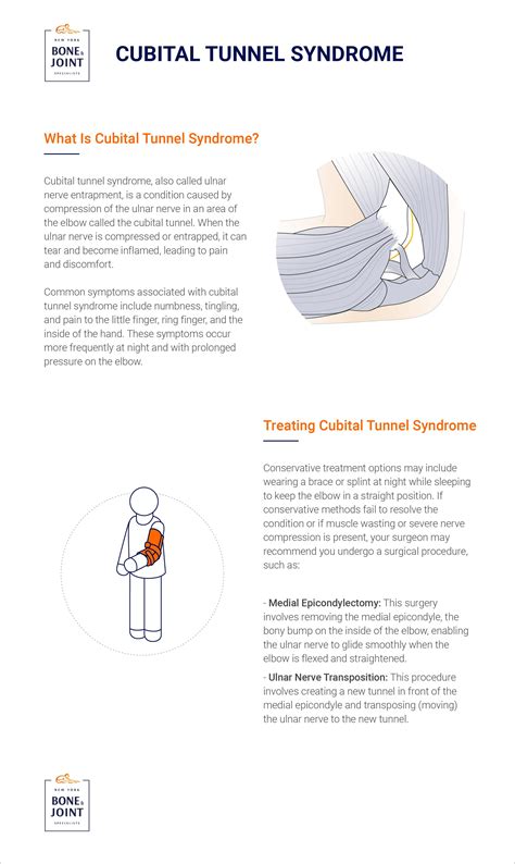 Cubital Tunnel Syndrome Specialist In Nyc Ny Bone And Joint