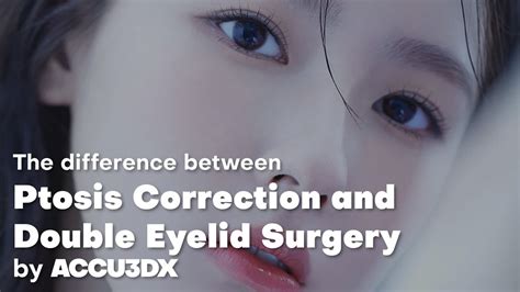 the difference between ptosis correction and double eyelid surgery youtube