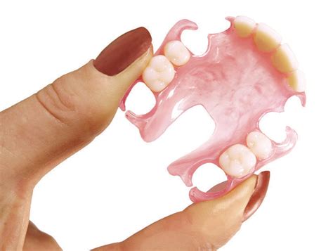 Flexible Partials Dental Prosthetic Services