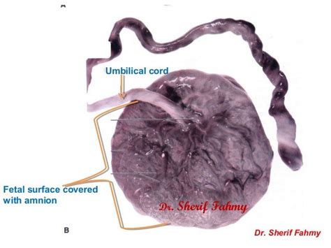 Placenta And Amnion General Embryology