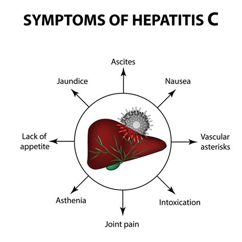 Symptoms Of Hepatitis C
