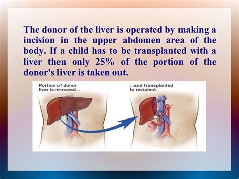 procedures for successfully carrying out a liver transplant