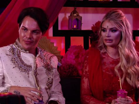 Towie Viewers Shock As Bobby Norris Reveals New Look After Nose Job
