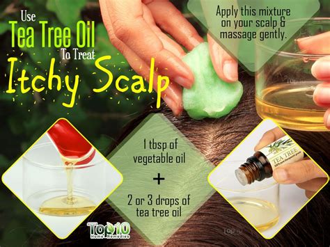 Dandruff and eczema (seborrheic dermatitis) are the you can spray it on your scalp with a spray bottle several times a week. Home Remedies for Itchy Scalp | Top 10 Home Remedies