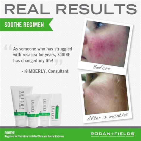 Improve Your Skin With These Great Tips Rodan And Fields