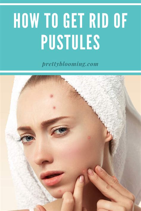 Pustules Why You Get Them And How To Treat Them Pustules Acne Skin