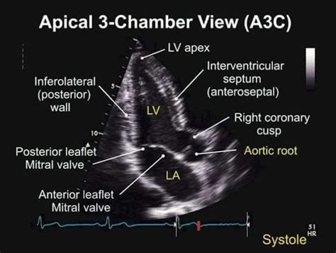 How To Do Echocardiography Standard Protocol For Performing