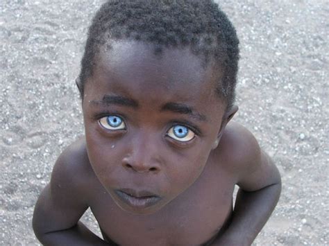 El niño con ojos de zafiro Cierto o Falso Planeta Curioso