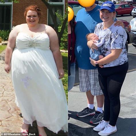 Woman Who Weighed 370 Pounds Loses 196lbs But Says Leftover Loose Skin Has Dampened Her Sex