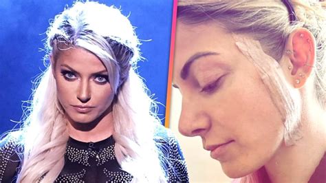 Wwe Star Alexa Bliss Reveals Skin Cancer Diagnosis Shares Message To Her Younger Self Latest News