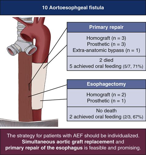 Repair Of Aortoesophageal Fistula With Homograft Aortic Replacement And